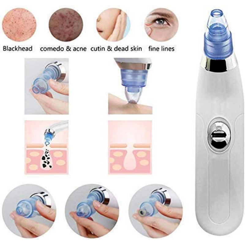 DermaSuction: Vacuum Pore Cleaning Device with 4 Suction Heads