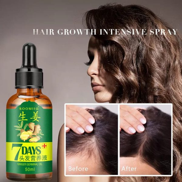 7-Day Ginger Germinal Oil: Hair Growth Essence - 30ml