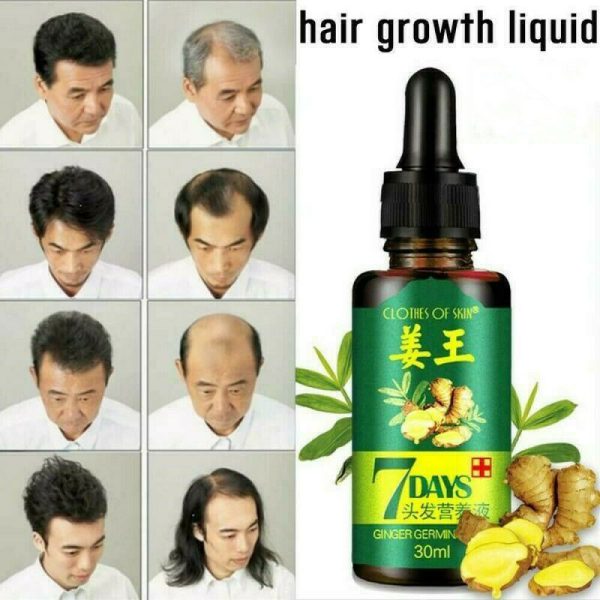 7-Day Ginger Germinal Oil: Hair Growth Essence - 30ml