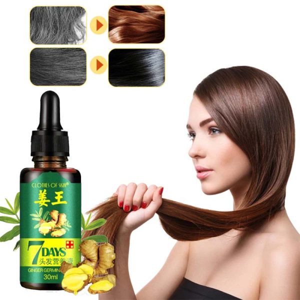 7-Day Ginger Germinal Oil: Hair Growth Essence - 30ml