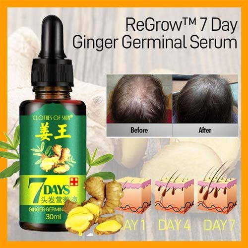 7-Day Ginger Germinal Oil: Hair Growth Essence - 30ml