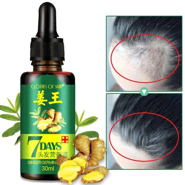 7-Day Ginger Germinal Oil: Hair Growth Essence - 30ml