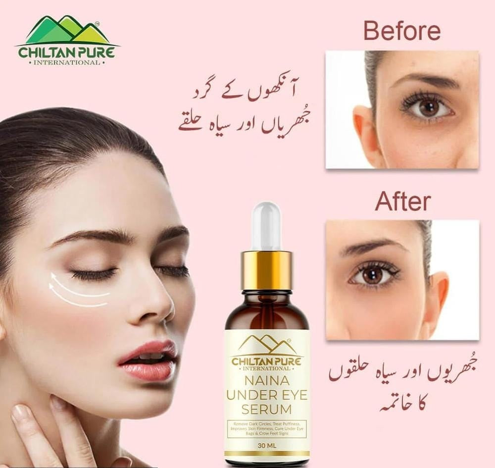 Chiltan Pure: Naina Under Eye Serum